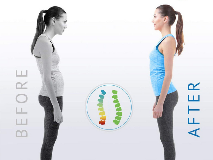 Posture Corrector